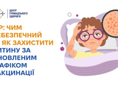 Кір: чим небезпечний та як захистити дитину за оновленим графіком вакцинації