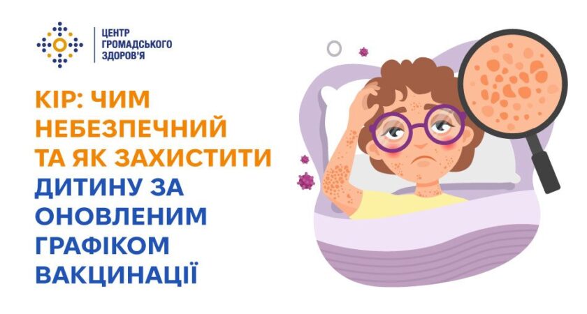 Кір: чим небезпечний та як захистити дитину за оновленим графіком вакцинації